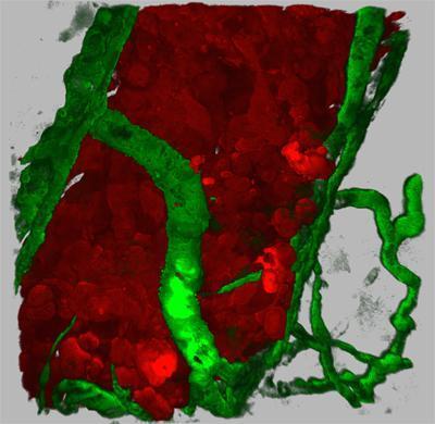 VEGF secreting human tumor cells inducing angiogenesis within the Zebrafish body wall. Tumor cells are shown in red (DsRed), fish blood vessels are shown in green (GFP). (Credit: UCSD School of Medicine)
