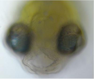 Zebrafish face with cleft palate. (Credit: Courtesy of John Postlethwait)