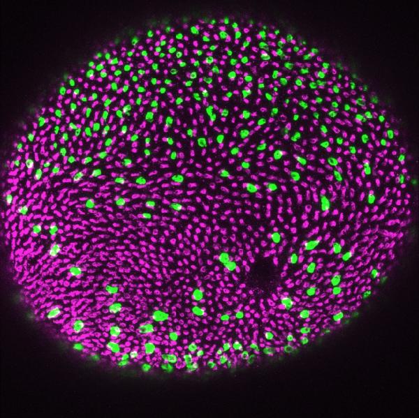 This fireworks display is actually a microscope image of a zebrafish retina immunolabeled for ultraviolet cones (magenta) and rods (green). The image shows the regular pattern of the cones and the scattered pattern of the rods typical of a normal fish. The labeling was performed by Karen Alverez-Delfin, doctoral candidate at Florida State University. (Credit: Florida State Associate Professor James Fadool and Alverez-Delfin)