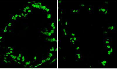Sections of zebrafish intestines show more proliferating cells (in green) in fish reared in the presence of microbes, left, versus those reared under sterile conditions at right. (Credit: Courtesy of Karen Guillemin)