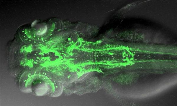 Colored overall view of a zebrafish nervous system. (Credit: Driever and Ryu)