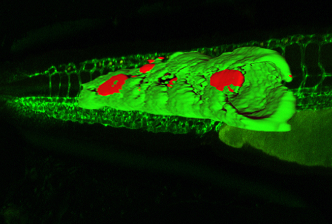 This zebrafish was engineered to carry a fluorescent antibody that binds to bad cholesterol. Credit: UC San Diego School of Medicine